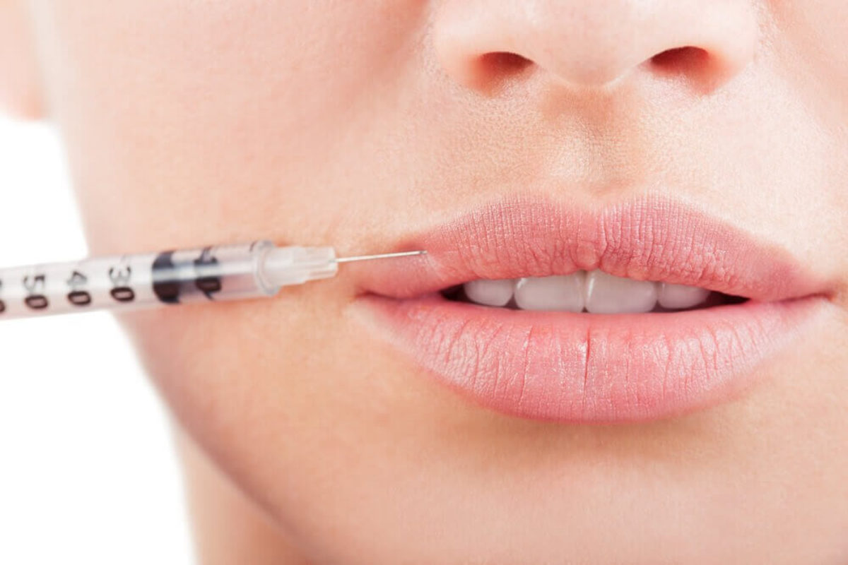 Women who are in the world of beauty and fashion will mostly prefer to use filler lips.